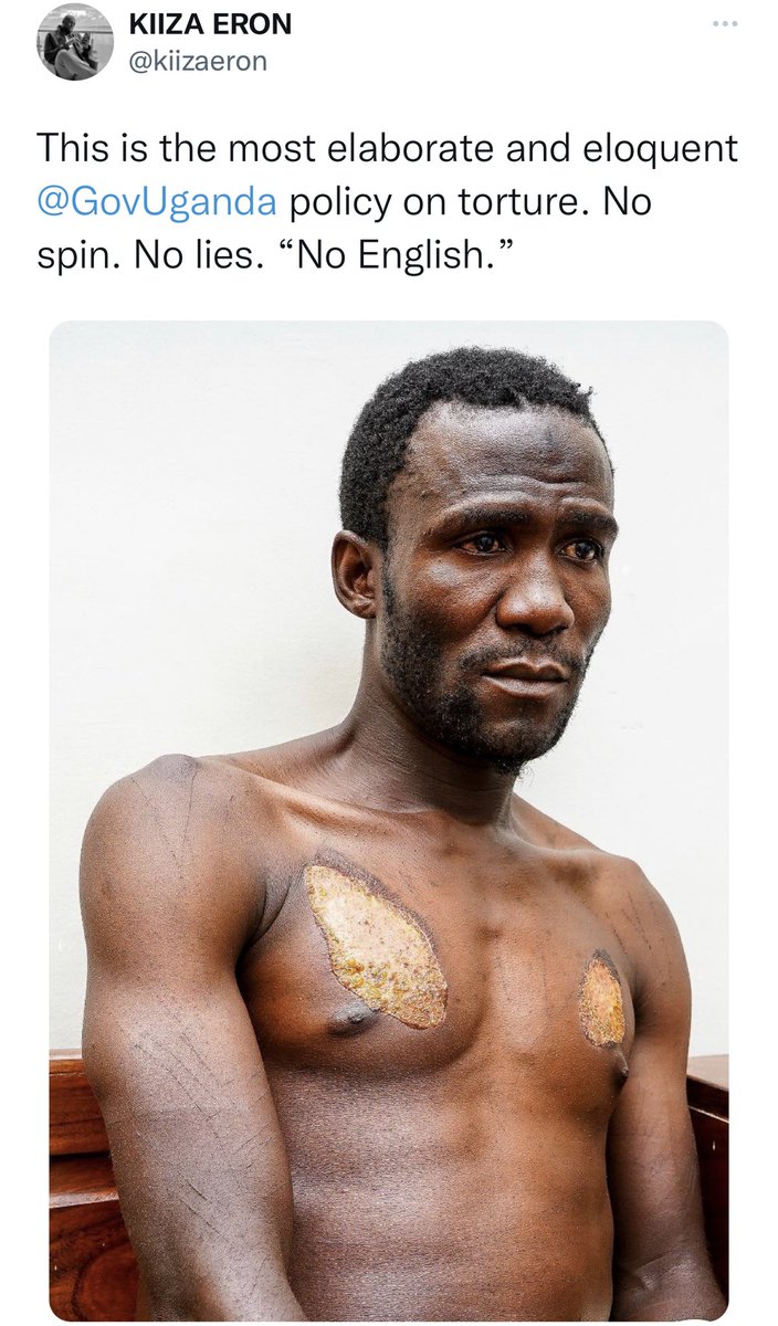 FreeUganda10's tweet photo. @ZelenskyyUa @KagutaMuseveni All Dictators like @KagutaMuseveni must fall.That's the only way you can help the World 🌎.The outcome of keeping quiet is death of innocent people #ENDM7Dictatorship #KUNGA #DEFUNDM7 @UN @G7 @hrw @UN_HRC @RoyalFamily @UKParliament @IntlCrimCourt @usmissionuganda @TheProgressives https://t.co/ljTGGkSrlr