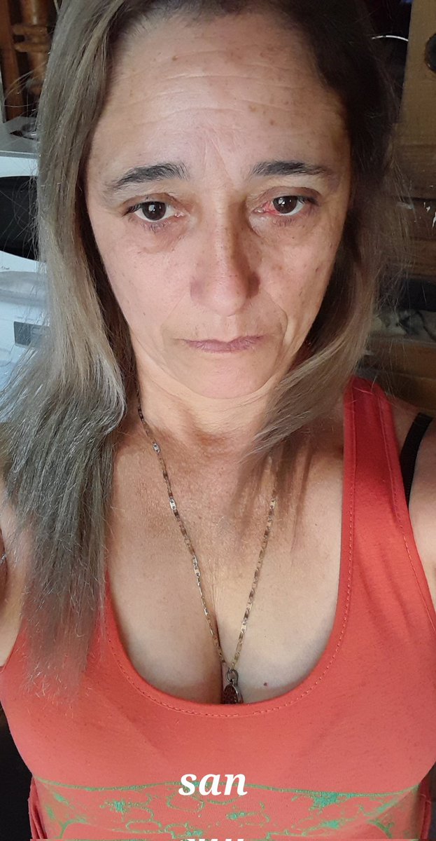 SandraG_74's tweet photo. Hola a mis seguidores bellos 😍😘
Les cuento que amanecí con mi ojo así . Entre mi color de pelo y mi ojo envejeci 10 años más 😢😢😢
Estoy pra el cajón 😞😞
Necesito trabajar urgente si pueden compartir este Twitter se los agradezco mucho 🙏🙏🙏
Los quiero mucho 😘😘 https://t.co/rwM9yDocsp