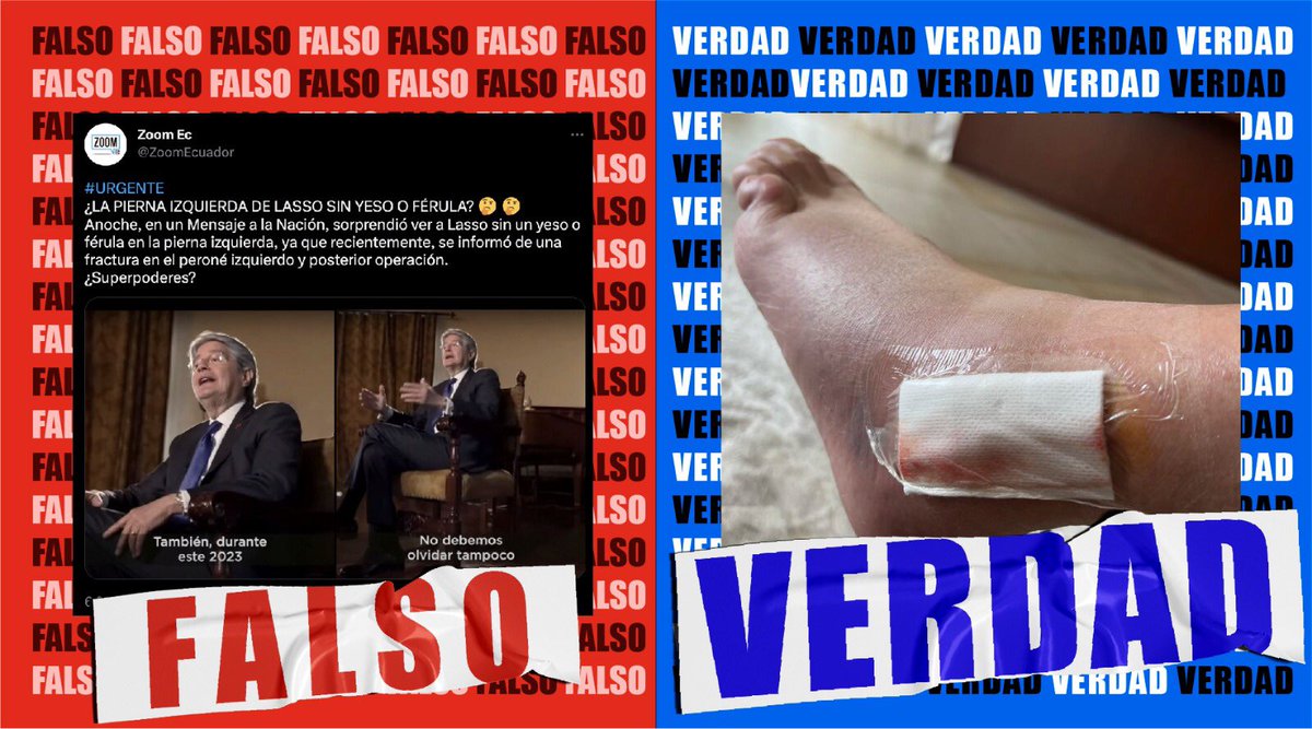 SegcomV's tweet image. Frente a la cantidad de noticias falsas generadas respecto a la operación del primer mandatario es importante aclarar que en la actualidad las cirugías de este tipo no inmovilizan del todo al paciente. Su intervención fue exitosa y su proceso de recuperación va por buen camino.