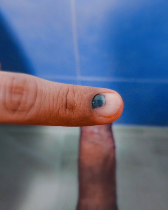 Ya ser&aacute; casi un mes que me machuque el dedo en mi trabajo y mi u&ntilde;a sigue as&iacute; 🥺🥺 creen que se caiga?😪😪<a href="/tag/lunesdemorboyprovocaci%C3%B3n"class="tags"><span>#lunesdemorboyprovocaci&oacute;n</span></a>