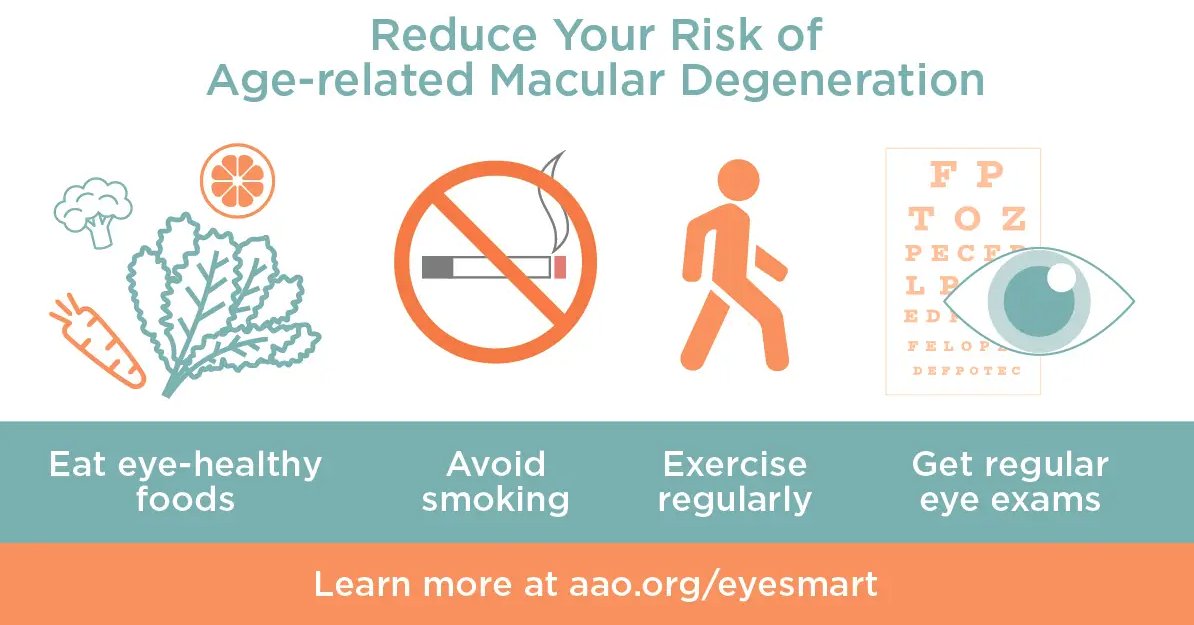 SCEYES's tweet image. Do you know the ways to reduce your risk of #AMD? #AMDAwarenessMonth @CHAHPMedCenter @AcademyEyeSmart @MacularHope @MacularSociety
