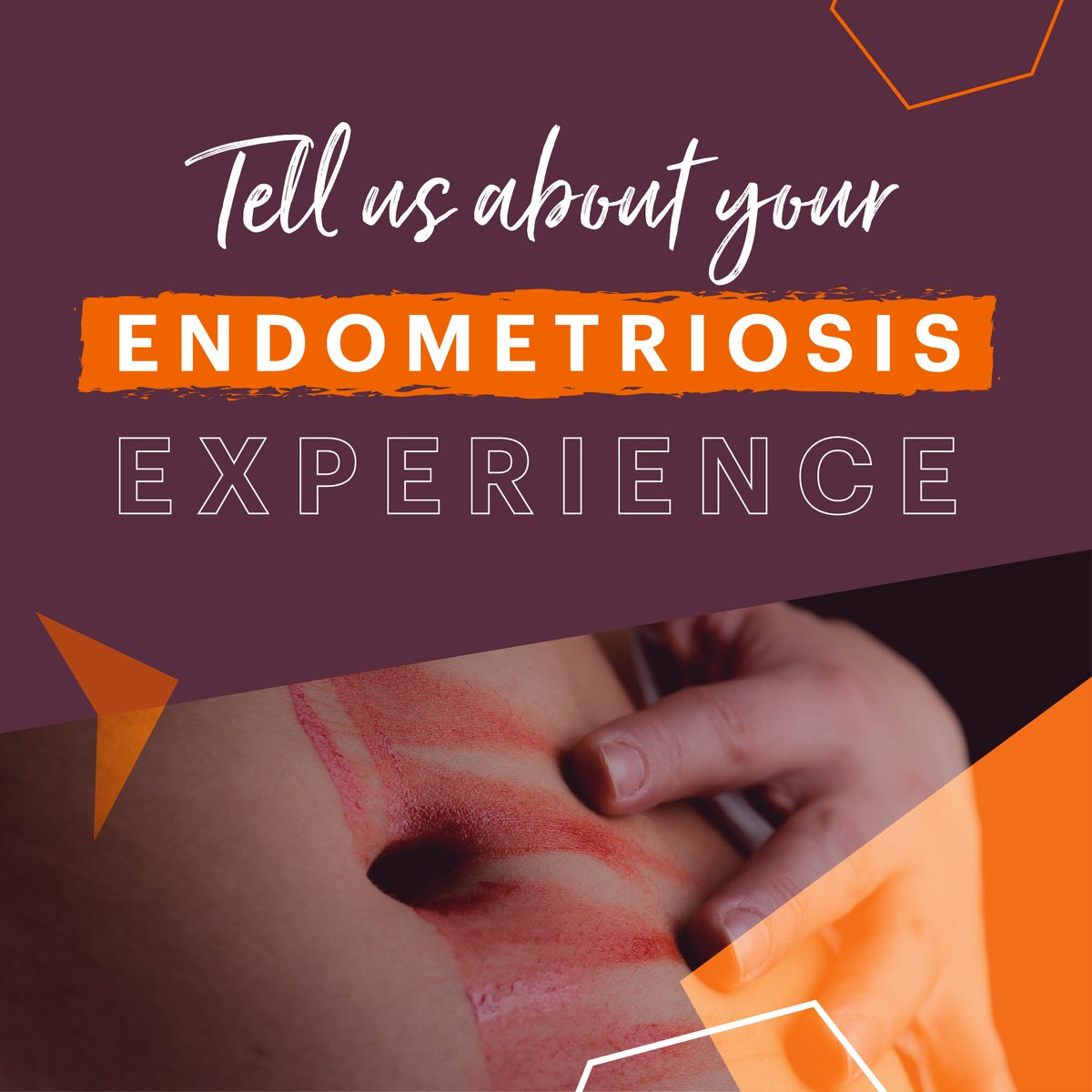 We’re looking for women to provide us with their insights into the realities of living with #endometriosis – from presentation of symptoms, the pain and the diagnosis (or not), how you manage your condition and what it means for your everyday life.