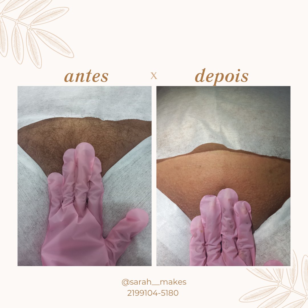 Sarahmake2's tweet photo. Espaço Charme Ela&amp;Ele ⚘️ 
Epilação virilha total 
Agende seu horário 
Atendimentos a Home care.
2199104-5180 ⚘️💅 https://t.co/fwG4wKvyvX