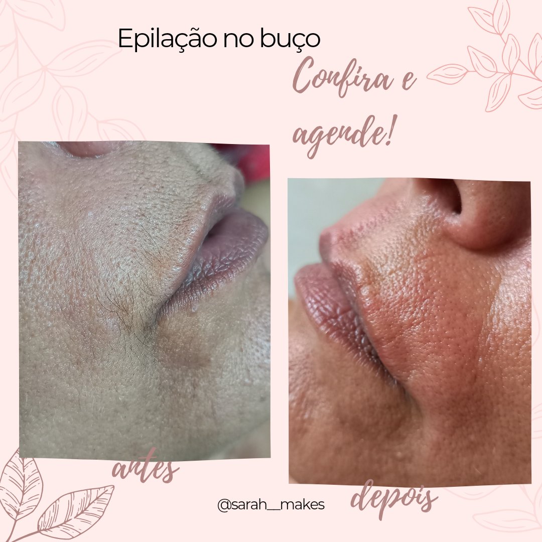 Sarahmake2's tweet photo. Espaço Charme Ela&amp;Ele ⚘️ 
Epilação no Buço.
Agende seu horário 
Atendimentos a Home care.
2199104-5180 ⚘️💅 https://t.co/RXfUEYXgCG