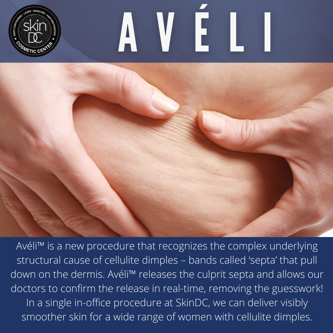 SkinDCDerm's tweet photo. Prepare for summer and say goodbye to your cellulite 👋

In a single in-office procedure at SkinDC, we can deliver visibly smoother skin for a wide range of women with cellulite dimples. 

Schedule a Cellulite Consultation at SkinDC today by booking online a... https://t.co/mNkt6AkWJx