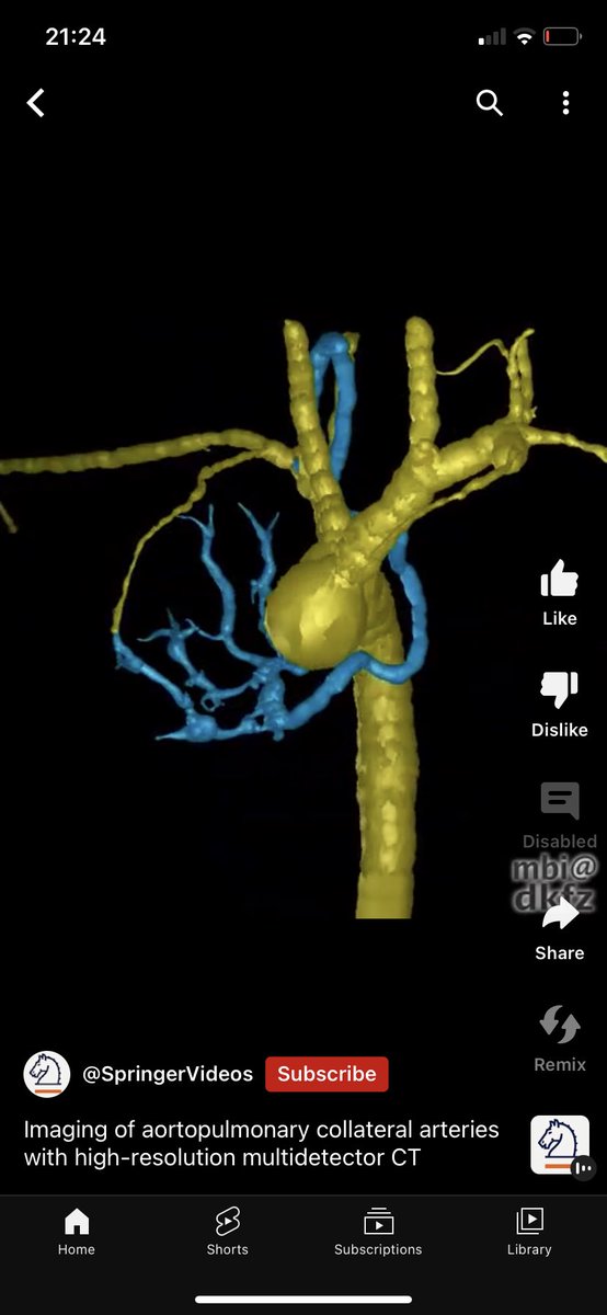 All cardiologists how do you fix MAPCA!