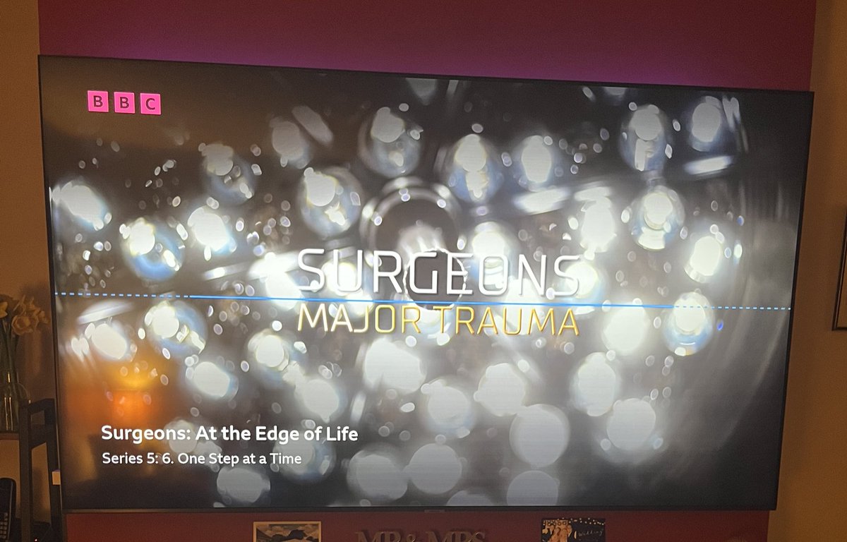 Recommend for anyone to watch this BBC programme on the Major Trauma team at Addenbrookes, Cambridge. Gives you a honest &amp; real glimpse into the complex nature of poly trauma patients &amp; the amount of team members involved to save lives🚁
#surgeonsattheedgeoflife #majortrauma #bbc