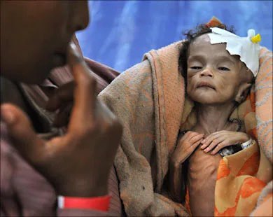 People in the US, UK, Saudi Arabia and Emirates
Stop your governments / rulers 
Like millions of others, this child is being starved because of these countries' blockade and besiege of Yemen.
Stop this WAR CRIME.
#YemenCantWait 
gogetfunding.com/emergency-appe…
