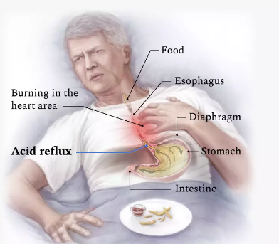 berdyaboi's tweet photo. wait dont go yet let me show you my acid reflux picture of a guy eating fries with ketchup while he falls asleep https://t.co/ux3phn3YBF