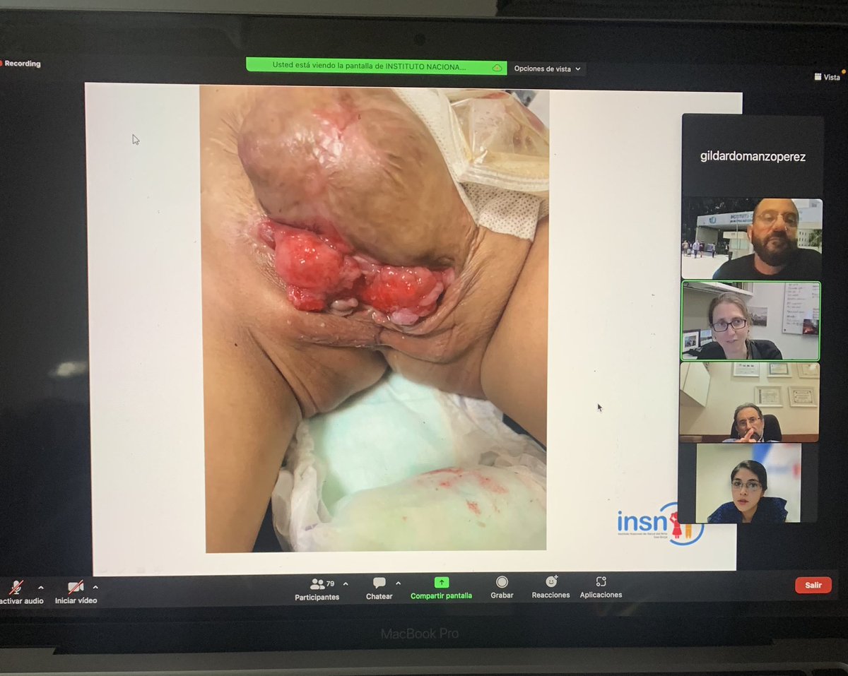 siupurol tweet media