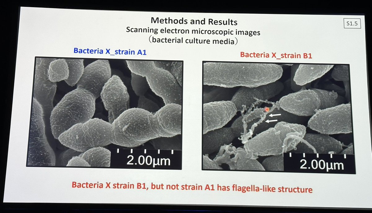 drbarrysinger's tweet image. Takewaki:  Bacteria X strain B1 associated with secondary-progressive #MS #SPMS. Has flagella that can bind to colon. Induces pro-inflammatory Th17 immune cells.  #ACTRIMS2023 #ACTRIMSForum #microbiome