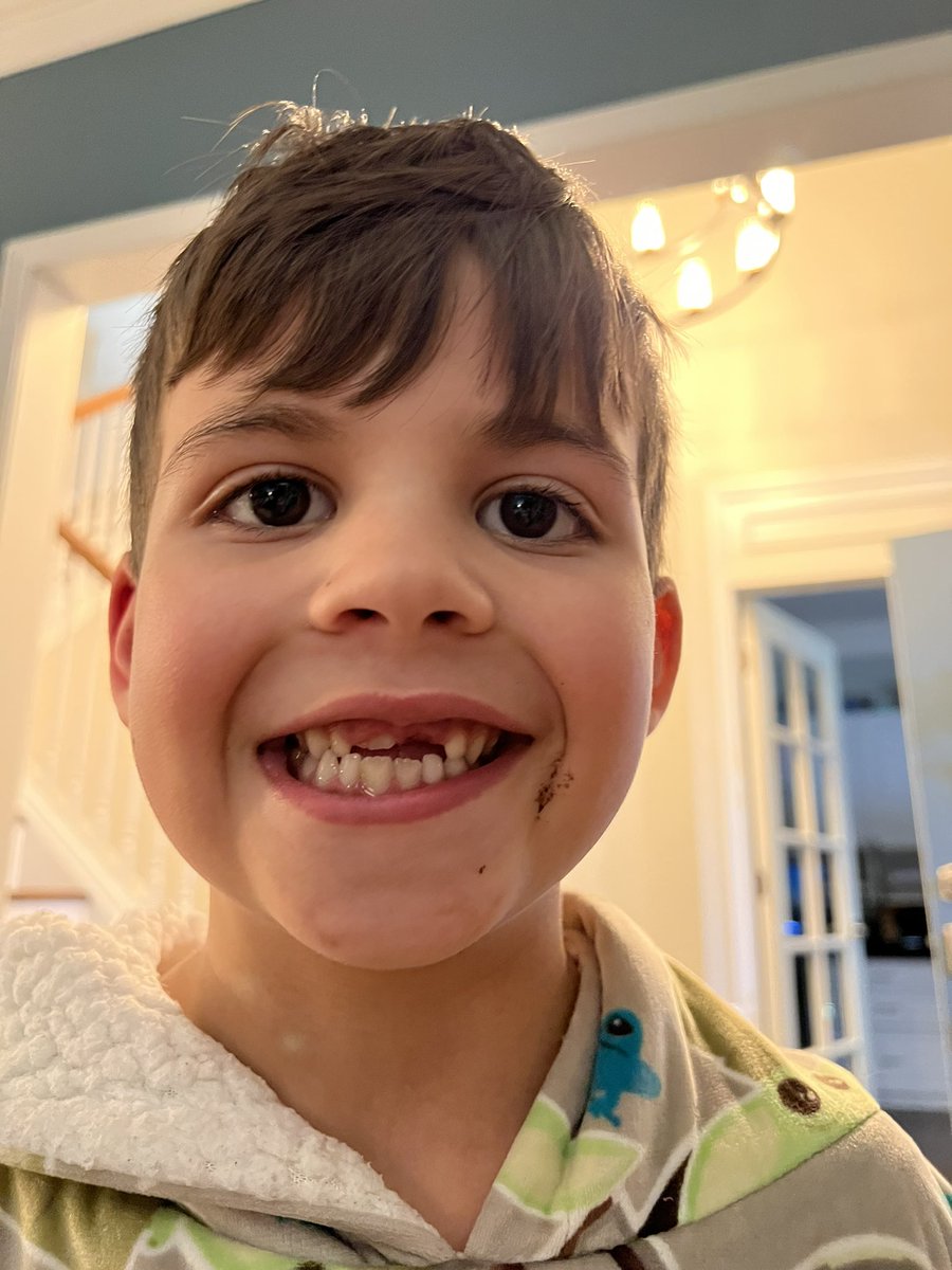 Renjenn03's tweet photo. He was so bored staying home from school that he decided to pull out both his front teeth. https://t.co/jedtc76sDB