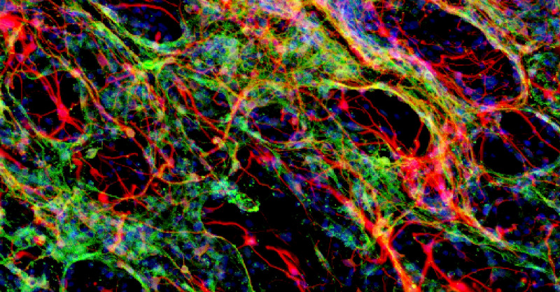 HokkaidoUni's tweet photo. @ICReDDconnect researchers showed synthetic #hydrogels provide an effective scaffold for neuronal #tissuegrowth in areas of #brain damage.
Read more below 👇
#regeneration #tissueregeneration #softmatter #neuroscience #research #science #ICReDD #HokkaidoUniversity #北海道大学