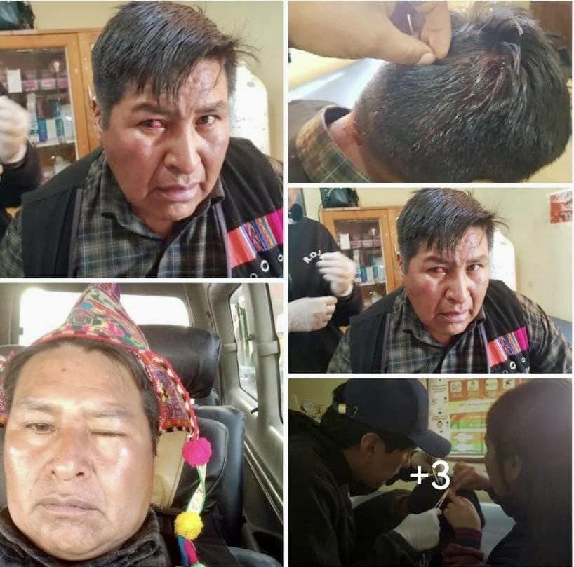 <a href="/evoespueblo/">Evo Morales Ayma</a> Oye cara de chuño mira como mandaste a maltratar a Martín Choque por quitarte la silla, maldito.