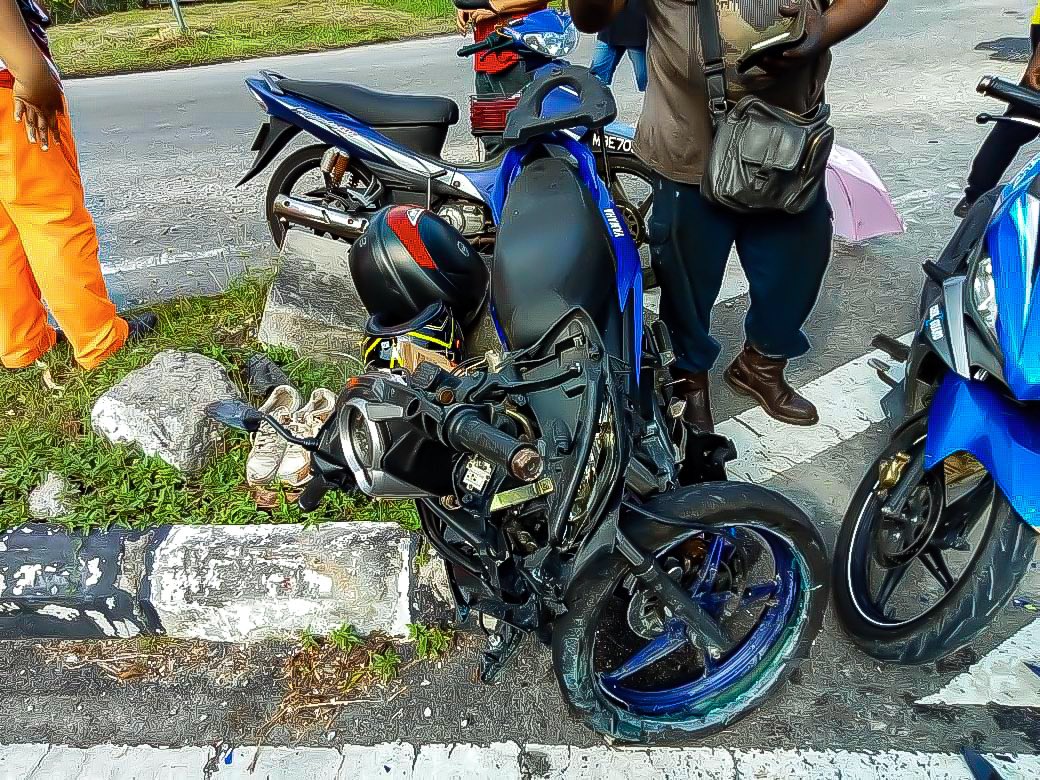 hazreeq88's tweet photo. Luahan Hati Seorang Pekerja Kemalangan Jalan Raya Kepada PERKESO

Pada 10.08.2022 ,saya tlah terlibat kemalangan jalanraya yang hampir meragut nyawa saya semasa pulang bekerja(lengkap berpakaian coverall).tlg retweet gais 🙏🏻
@Sivatronoh  @PERKESOofficial @AdamAdli @anwaribrahim https://t.co/DFyXikHBUP