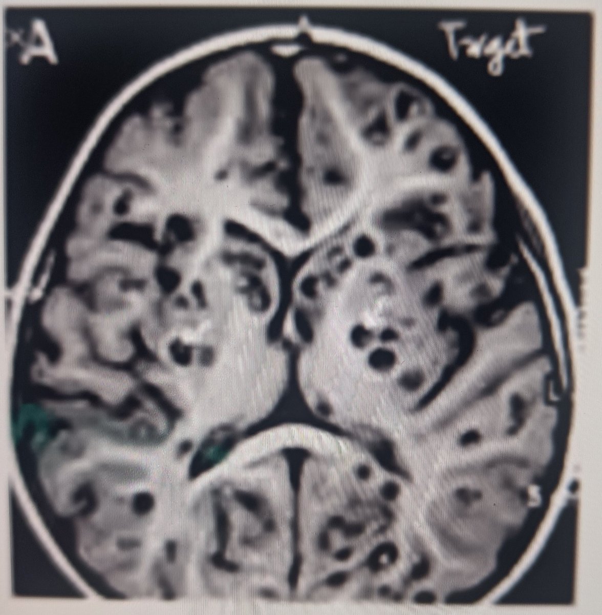khurafatidoc's tweet image. Kya dikh raha hai?
#targetsigns