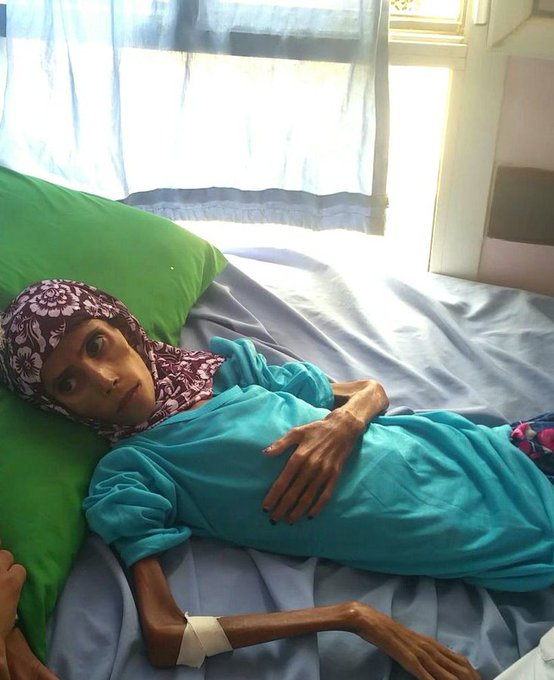 ChiefSharp's tweet photo. ALL CHILDREN HAVE THE SAME RIGHTS AS OUR OWN

Please join the Twitter Storm for the innocent children in Yemen and around the world to amplify their voices and call for action.

Every Friday 18:00 GMT

#YemenCantWait #HelpSyria #FreePalestine #StopAllWars #SaveChildren https://t.co/ULBSGZfAHg