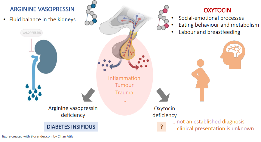 Oxytocin - sometimes called the love hormone but we also think it could be a forgotten hormone. 

People with AVP-Deficiency are at high risk for oxytocin deficiency. However there is currently no way to test for this. 

This article explains more: bit.ly/3XE5yRG