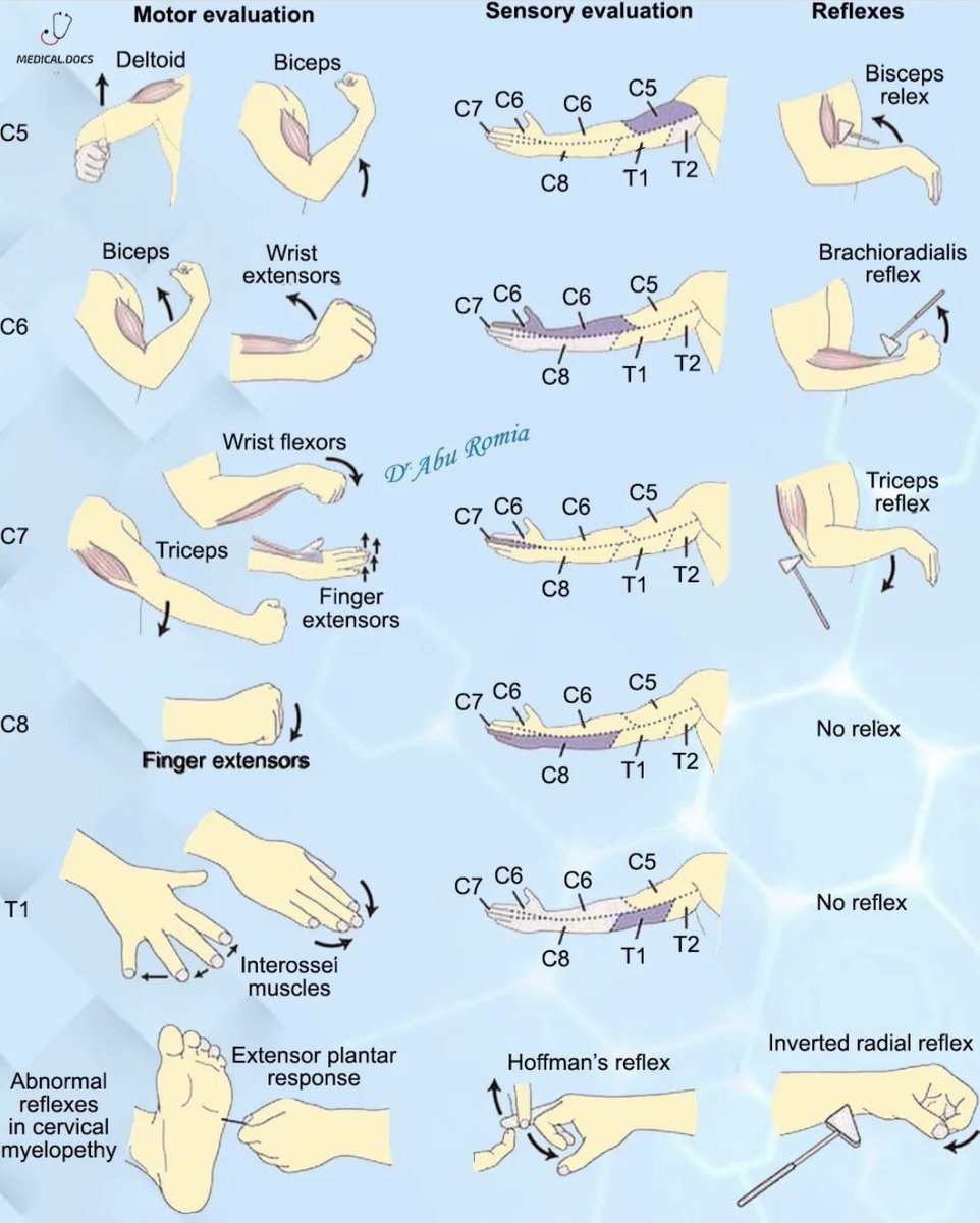 BrownJHM's tweet photo. Upper extremity neuro exam #(Dr Abu Romia) MedStudentTwitter https://t.co/Rj3iDhXYZI