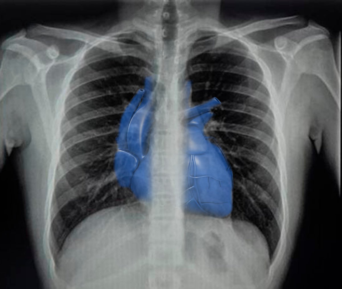 ⏳ 𝑷𝑹𝑶́𝑿𝑰𝑴𝑨𝑴𝑬𝑵𝑻𝑬... 💙 

#SanJosé2023