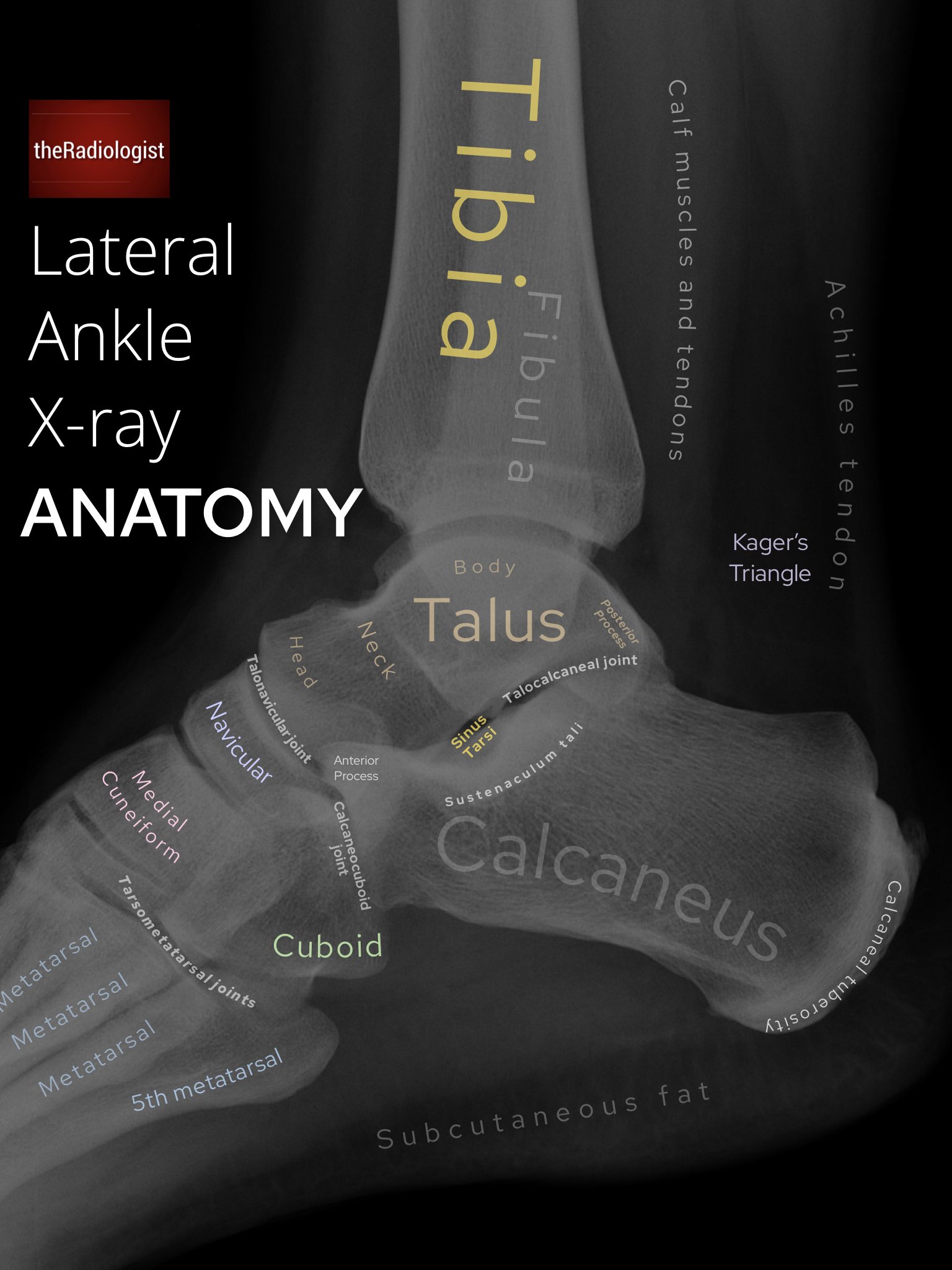 Lateral Ankle X Ray Anatomy Ankle X Rays Don't Forget The Bubbles