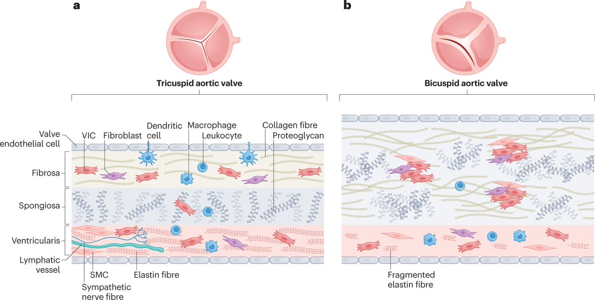 In our latest Review, Mathieu and colleagues discuss the mechanisms, prevention and treatment of calcific aortic valve disease: rdcu.be/c6kgo