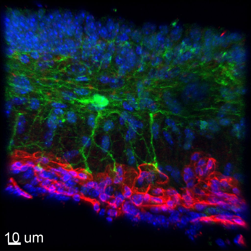 Neurobiology Imaging Facility at Harvard Medical (@hms_nif) on Twitter photo Happy #FluorescenceFriday
Image by @urs_langen, <a href="/GuLabNeuro/">The Gu Lab</a> of astrocytes (green, GFAP) in median eminence in touch with blood vessels (red, CD31)
Image was acquired on a <a href="/LeicaMicro/">Leica Microsystems</a> #SP8 confocal and processed using
<a href="/ImarisSoftware/">Imaris 3D/4D Imaging</a> Happy #FluorescenceFriday
Image by @urs_langen, <a href="/GuLabNeuro/">The Gu Lab</a> of astrocytes (green, GFAP) in median eminence in touch with blood vessels (red, CD31)
Image was acquired on a <a href="/LeicaMicro/">Leica Microsystems</a> #SP8 confocal and processed using
<a href="/ImarisSoftware/">Imaris 3D/4D Imaging</a>