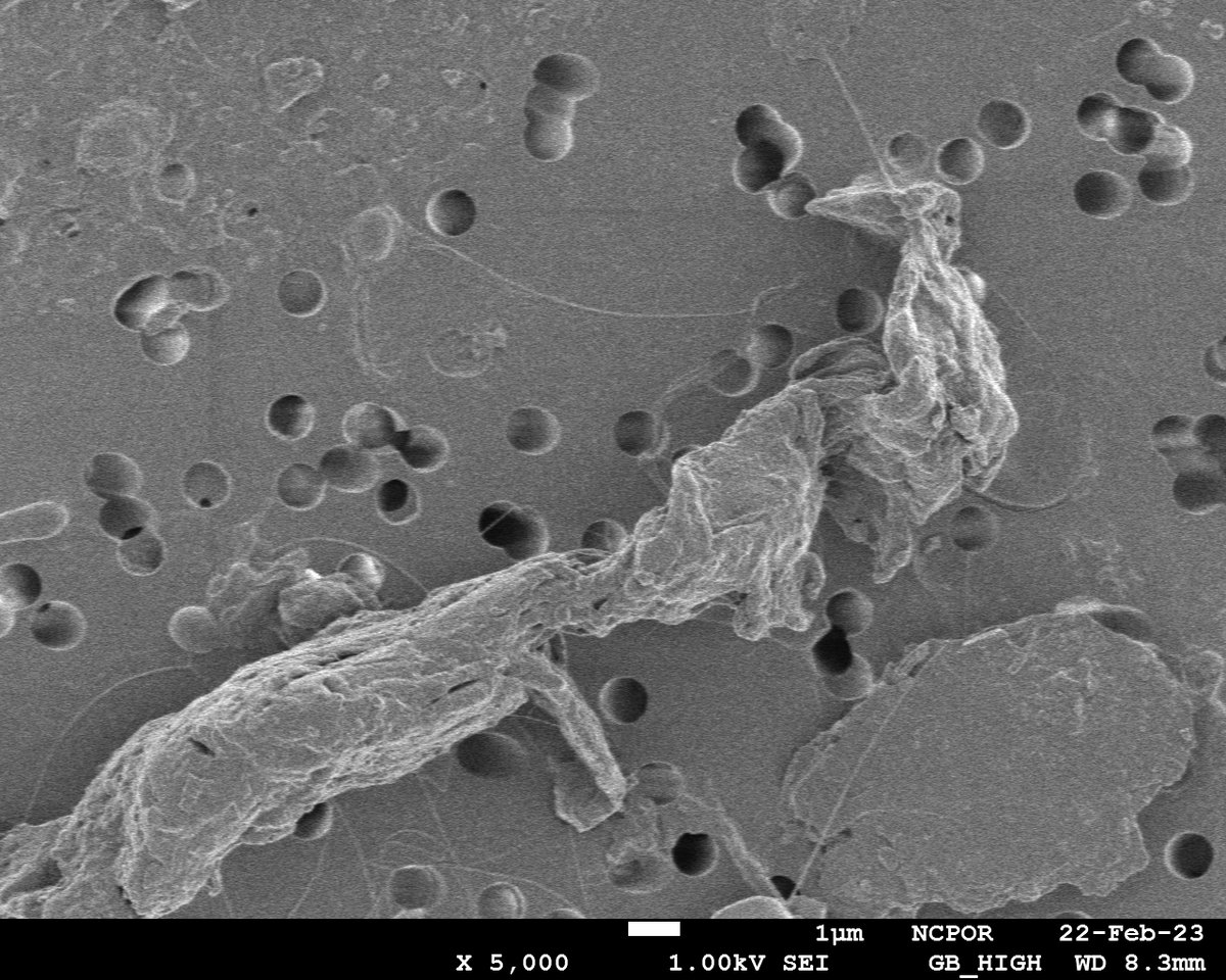SahinaGazi's tweet image. Filtrate on filter paper is a key step to prepare water sample for #electronmicroscopy analysis. However, interpretation takes on a new meaning such as this colored art (a perching bird enjoying pond view on a rainy day) made from a filter paper residue. Colors do create emotion.