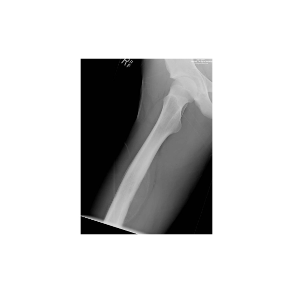 American College of Radiology on Twitter "A 16 yearold boy presents