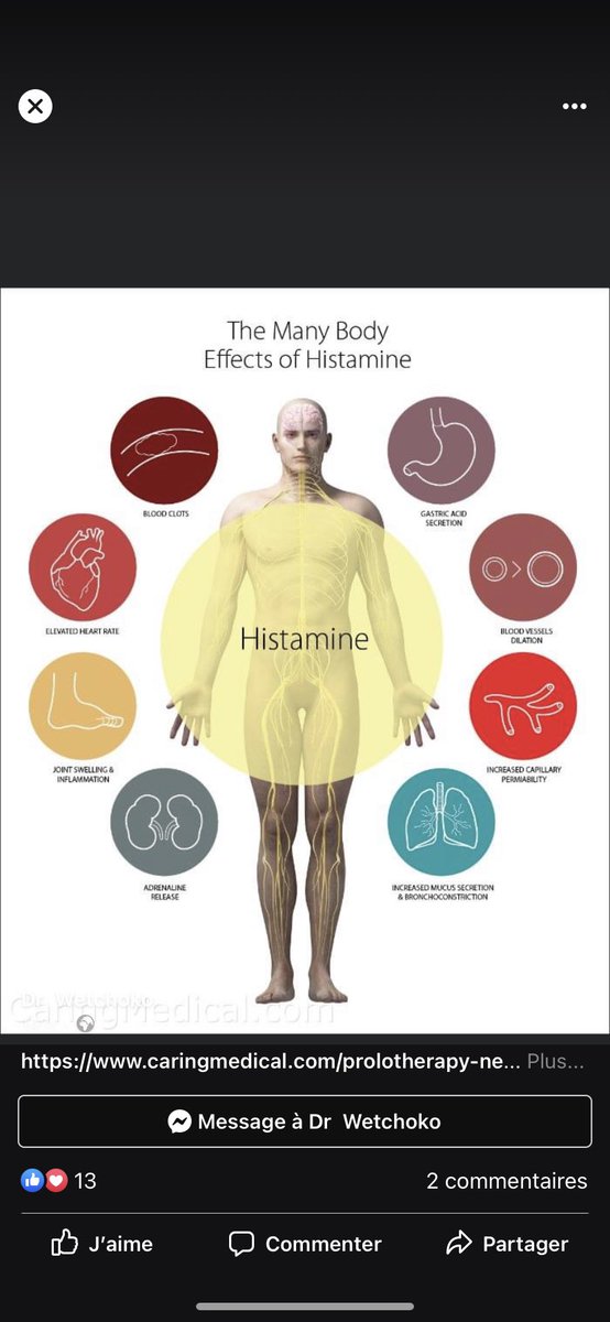 psyyko's tweet photo. https://t.co/g4ObGD5OTH 
Le covid long est aussi le développement de maladie du système immunitaire comme le syndrome d’activation mastocytaire SAMA c’est une maladie qui fait souffrir 
devenir allergique à la vie.. 
On en parle très peu ! #teamsama #teamhistamine #teambutyrate https://t.co/sJ3Y1yjaAN