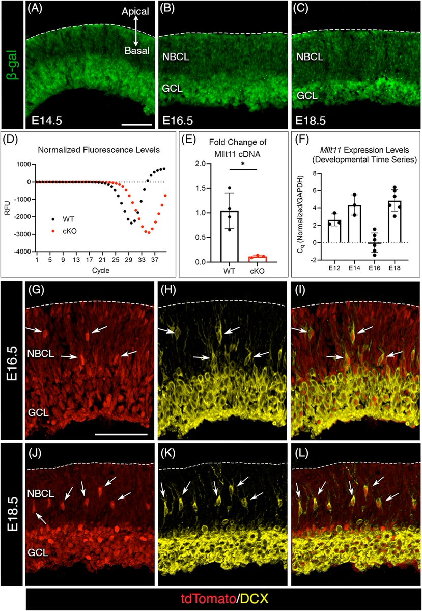 The #retina detects and processes visual information. Learn how #microtubule-interacting protein Mllt11 regulates #neuroblast migration and  #ganglion cell layer formation in functional #neuralcircuits, with implications for #neurodevelopmental disorders doi.org/10.1002/dvdy.5…