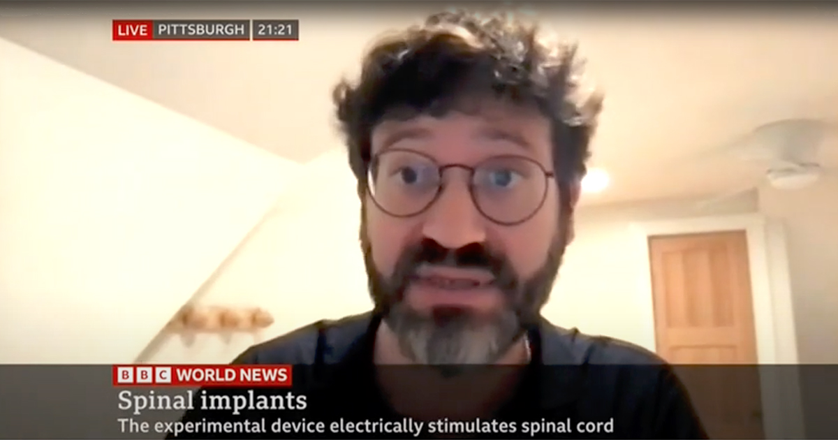 Pitt Neurosurgery (@pittneurosurg) on Twitter photo Nice interview on BBC World News with <a href="/MCapogrosso/">Marco Capogrosso</a> as he explains recent research showing how spinal cord stimulation can improve arm mobility after stroke. youtu.be/liXa5Ax8k2s <a href="/RNELabs/">RNEL</a> <a href="/PittTweet/">University of Pittsburgh</a> Nice interview on BBC World News with <a href="/MCapogrosso/">Marco Capogrosso</a> as he explains recent research showing how spinal cord stimulation can improve arm mobility after stroke. youtu.be/liXa5Ax8k2s <a href="/RNELabs/">RNEL</a> <a href="/PittTweet/">University of Pittsburgh</a>