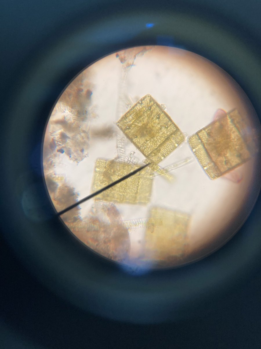 bostonschool_pa's tweet image. Students from 11th grade made observations of a sample of pond water through the microscope. They looked for protist organisms like green algae and parasites. #BSI #Panama #Education #Secondary #Biology