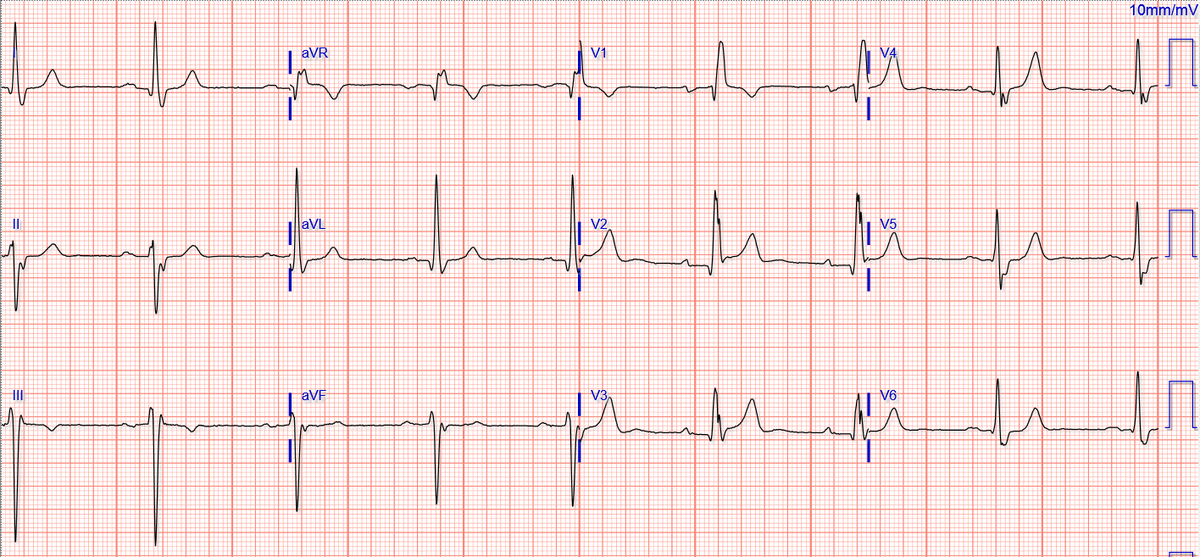 Brooks Walsh tweet media