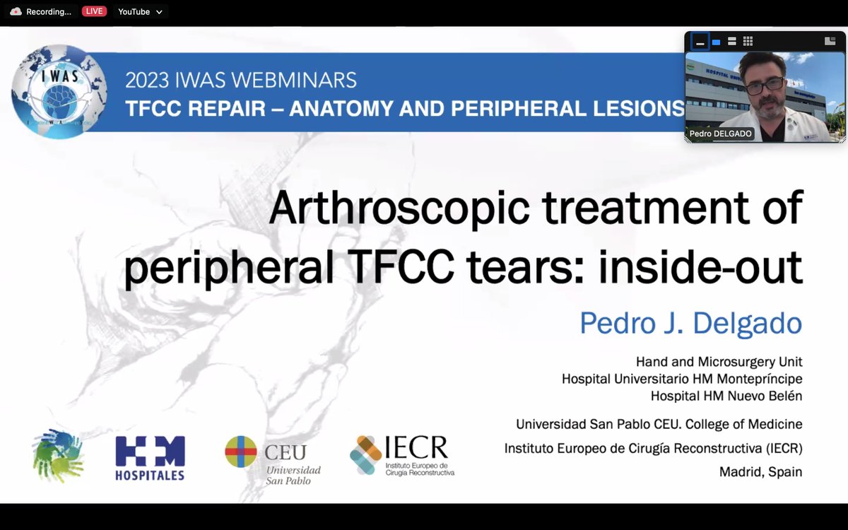 IWAS_Wrist's tweet photo. TFCC REPAIR - ANATOMY & PERIPHERAL LESIONS
Live >230 delegates today ๐
Recording on @IWAS_Wrist website
Next webinar: Friday 17 March 2023 https://t.co/zPGfaag8Kh