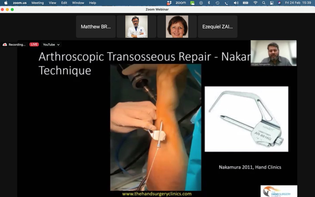 IWAS_Wrist's tweet photo. TFCC REPAIR - ANATOMY & PERIPHERAL LESIONS
Live >230 delegates today ๐
Recording on @IWAS_Wrist website
Next webinar: Friday 17 March 2023 https://t.co/zPGfaag8Kh