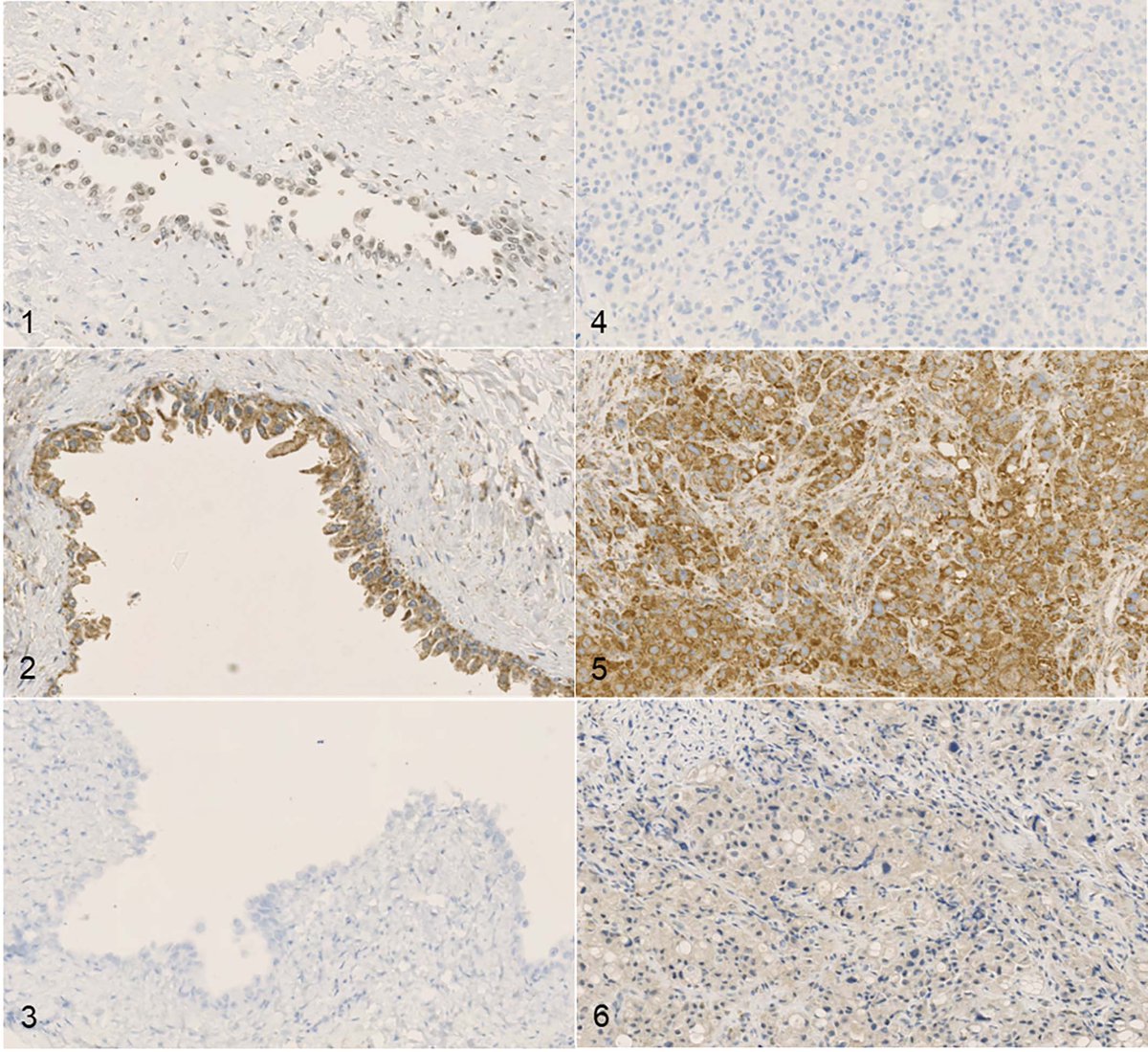 jvdi_aavld's tweet photo. February JVDI IN FOCUS. “Immunohistochemical analysis of expression of VEGFR2, KIT, PDGFR-β, and CDK4 in canine urothelial carcinoma,” Setyo et al.

JVDI 2023;35(2). https://t.co/22IwnlpcLj https://t.co/HqMMXQFS6C