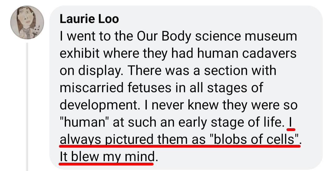 secularprolife's tweet image. So many people's pro-choice views seem to depend on believing embryos are literally spheres of cells.

"I always pictured them as 'blobs of cells'. It blew my mind."