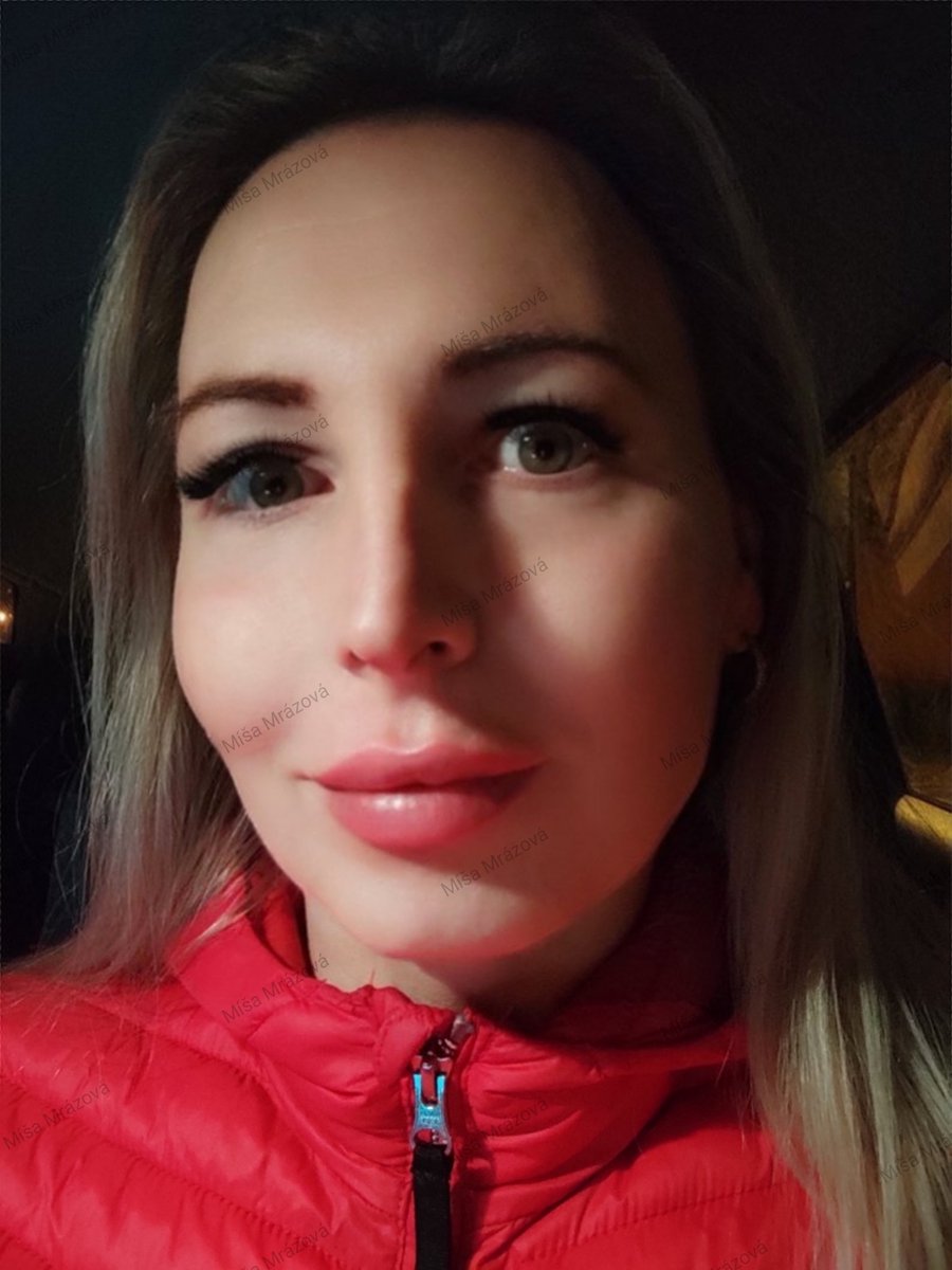 Misa_Mrazova's tweet photo. New kiss, new lips 😘 #newkiss #kiss #newface #botox #lips #lipsbotox https://t.co/CkRVV0xEID