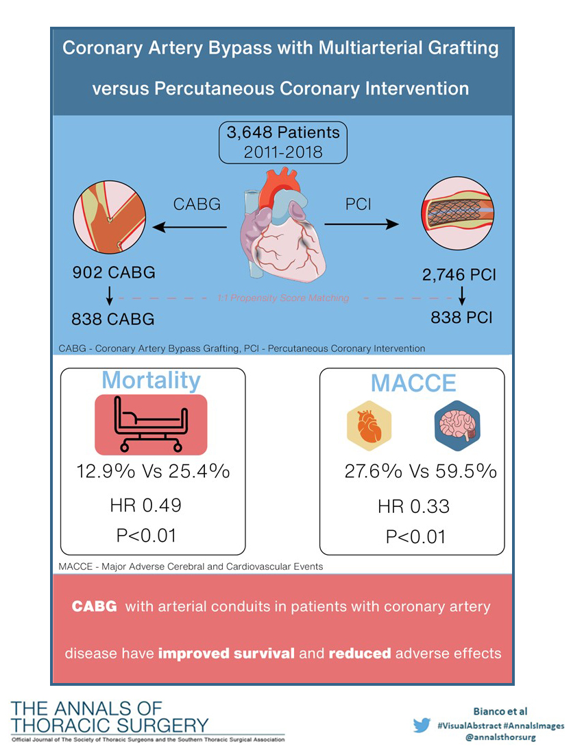 annalsthorsurg's tweet photo. #VisualAbstract from “Coronary Artery Bypass With Multiarterial Grafting vs Percutaneous Coronary Intervention.” Read the article from Bianco, @IbrahimSultanMD, and coauthors: https://t.co/VIjtMLVegd #AnnalsImages @SureshMulukutla @EdgarArandaMic1 @psyoon79 @CatalinPToma https://t.co/Liv93uumYX