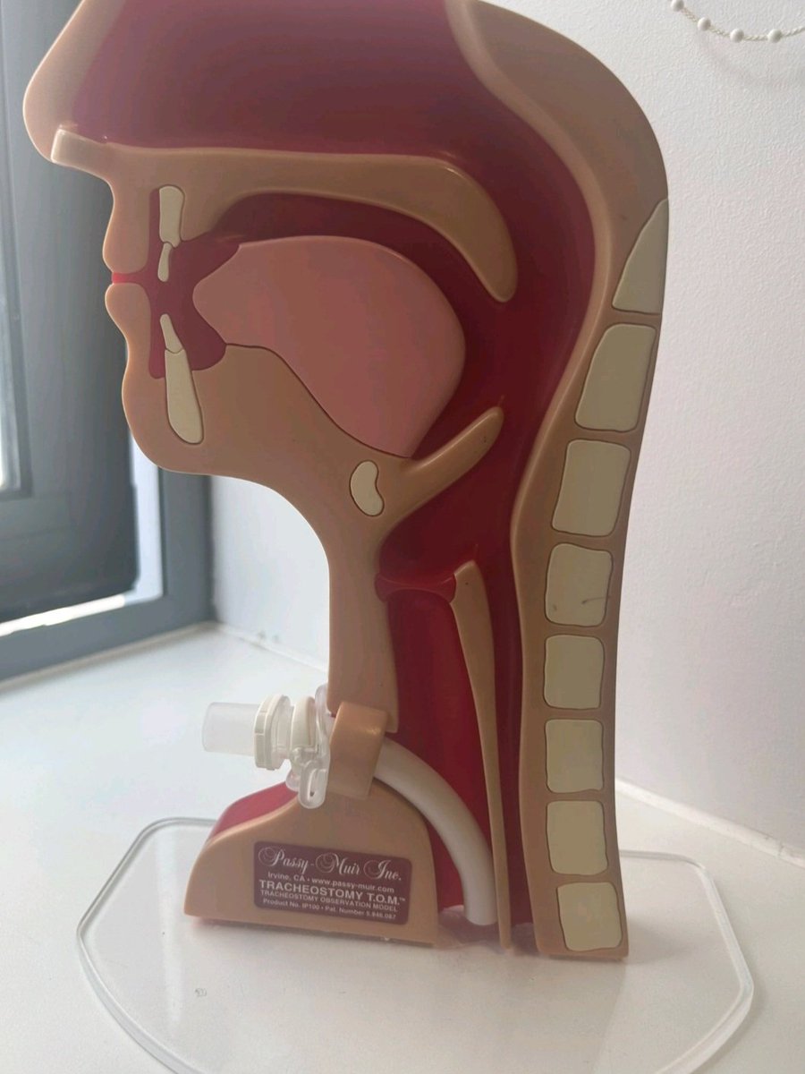 KirstyThomasson's tweet photo. Amazing afternoon and collaborative working to support the introduction of new tracheostomy tubes. Improving patient care is always a priority #respiratory #headandneck #PatientCare @ELHT_NHS https://t.co/QZlpHhpM9X