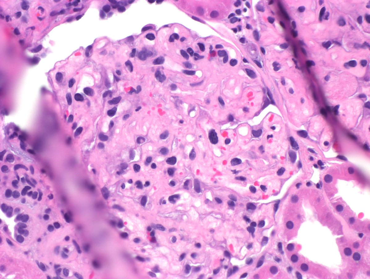 Kuang-Yu Jen, MD, PhD tweet media