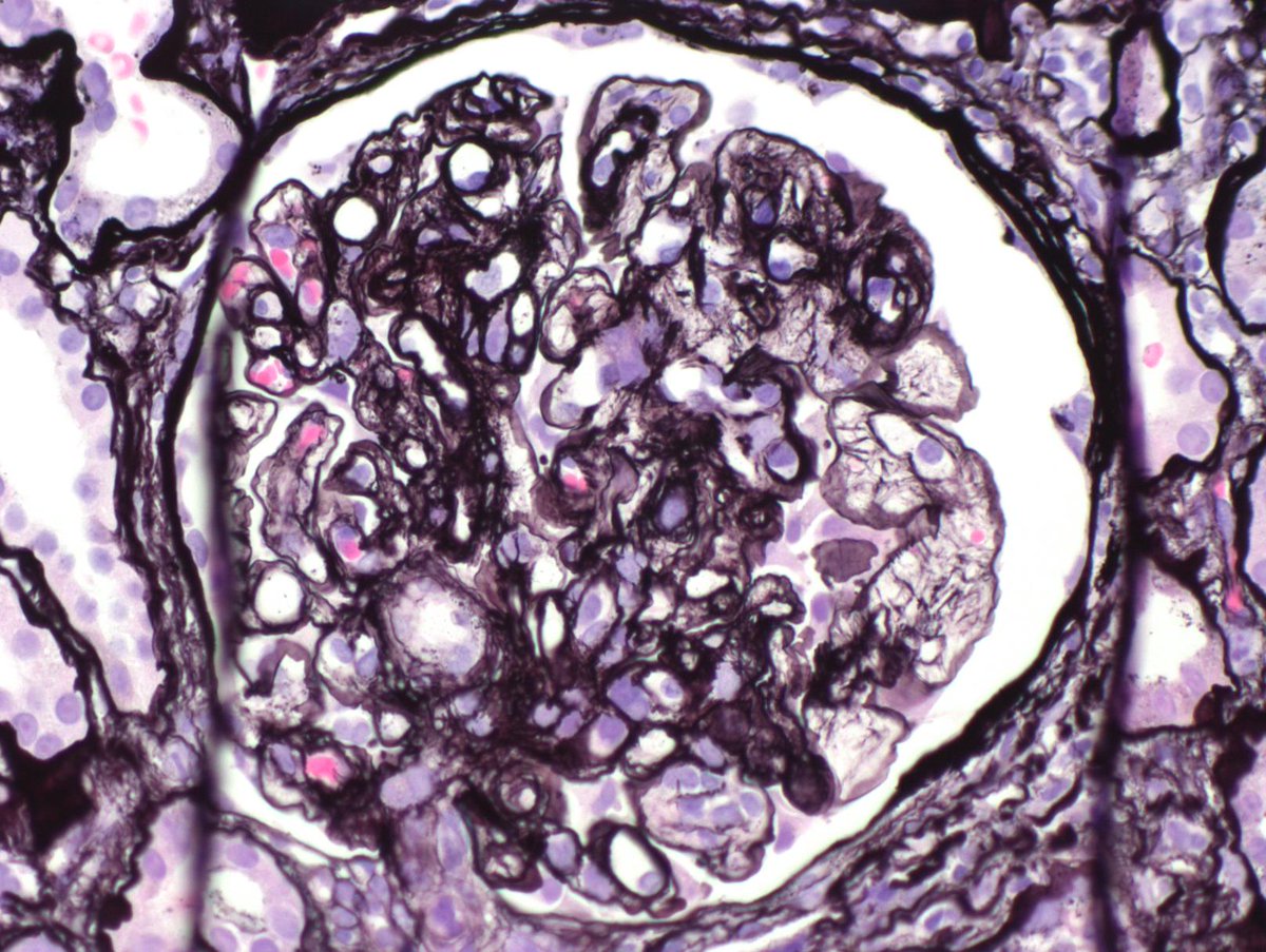 Kuang-Yu Jen, MD, PhD tweet media