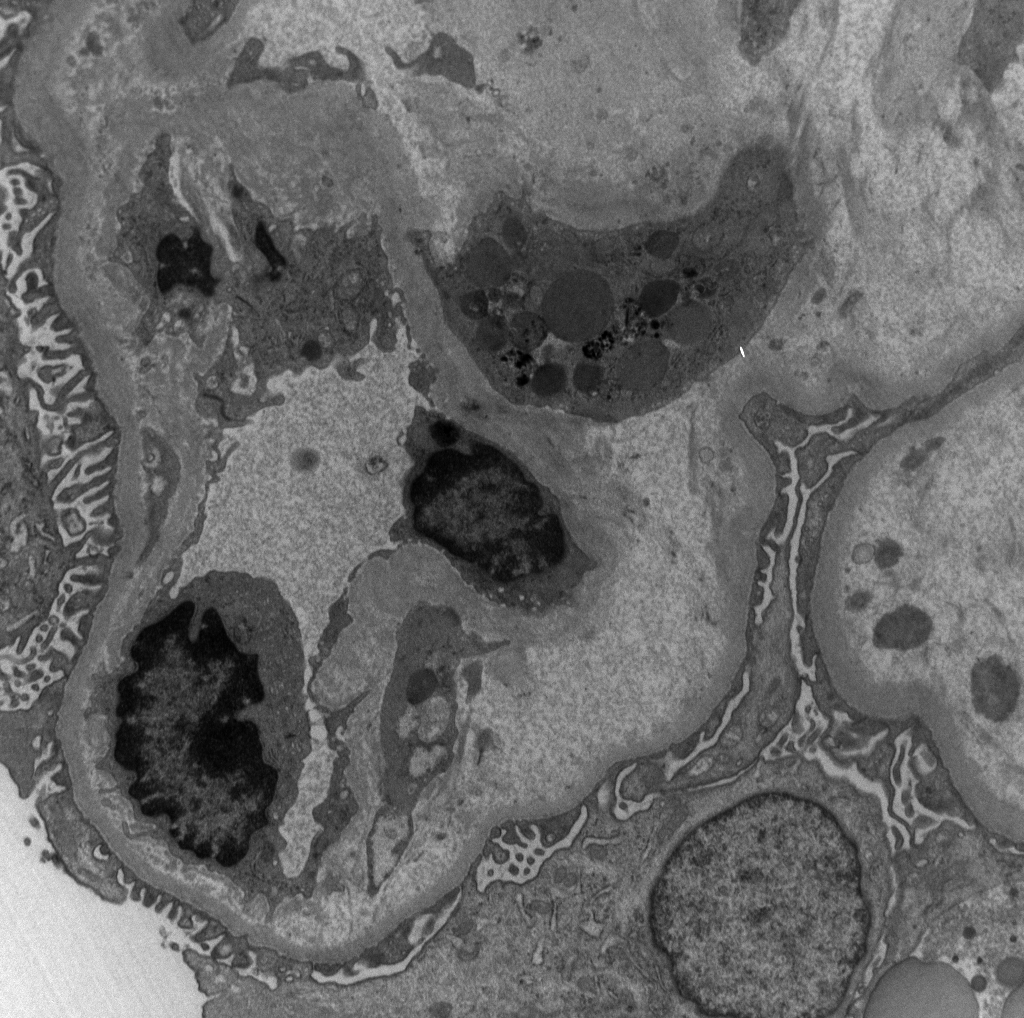 Kuang-Yu Jen, MD, PhD tweet media