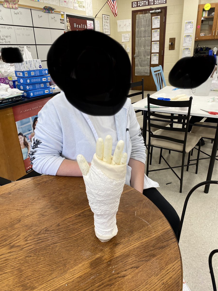 gooseRRT's tweet photo. Fracture refreshers and learning to cast a broken bone today!  🦴  @FHS_HealthSci @CTE_Mosley @FultonHigh @sjsmith2509 https://t.co/NJLElP0iNg