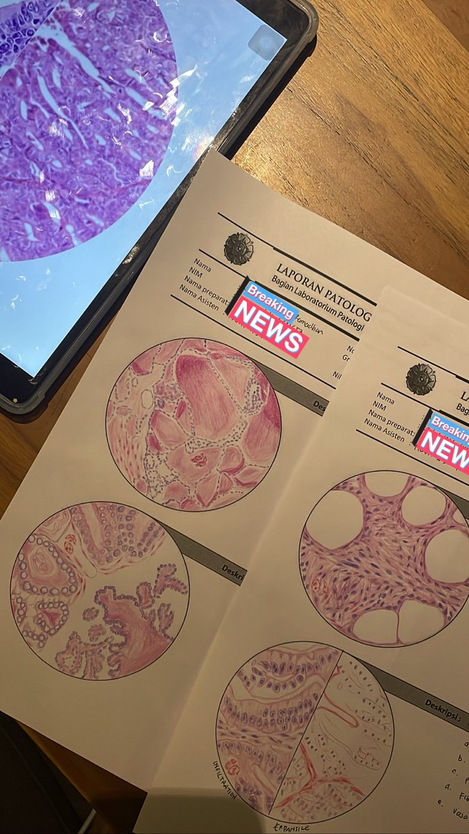 ark13__'s tweet photo. menggambar preparat PA terakhir di preklinik🥳🙌 bye PA https://t.co/XbpaTOTjkV