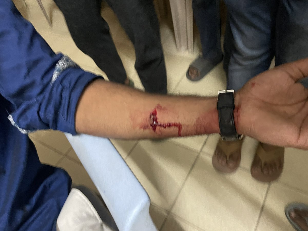 VishnuRupureddy's tweet photo. SFI violence politics has unleashed in @HydUniv , targetted and attacked tribal students and @abvpuoh karyakarthas with sharp knives. 

These goons of hatred should be booked and brought to justice. https://t.co/yzTlrohX2b