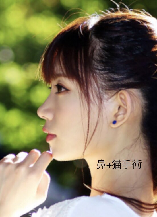 VinegaredKelp's tweet photo. ゴボで悩んでる方って1枚目みたいな横顔されてること多くない❔

こういうタイプって鼻高くすれば改善することが非常に多いと思う、
口を引っ込めたいという一心に下げるとせっかくの立体感が平面になっちゃう可能性も……

顔が立体的な人って「鼻〜口元」が前に出てるのよ、菅田将暉とかまさにそう https://t.co/UdklOptqCQ