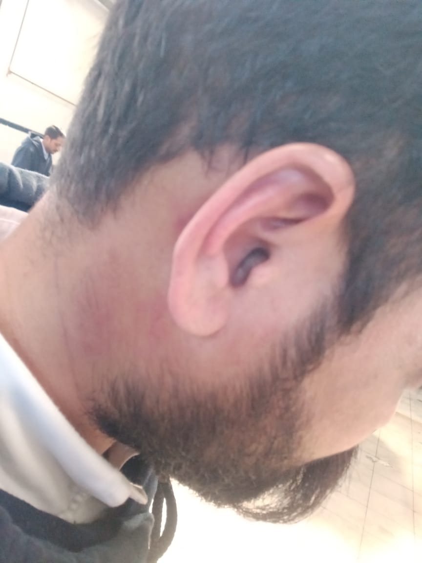 MechTechPankaj's tweet image. सुमित की फेसबुक पोस्ट से अप्पति थी तो कानून उसको सजा देता लेकिनअसमाजिक तत्वों द्वारा कानून हाथलेकर जानलेवा हमला किया गया यह हिमाचल प्रदेश में गुंडा प्रवति के लोगोंको बढ़ावा देना है |असामाजिक तत्वों केऊपर सख्त कार्यवाही होनी चाहिएहिमाचल प्रदेश एक शांतिप्रिय प्रदेश है|
#Justice