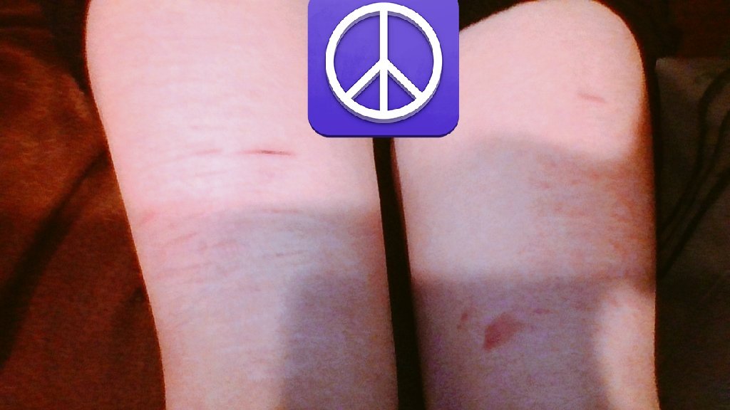 fayeplastictree's tweet photo. the scars on my thighs r so ugly https://t.co/Ht1KnAOWko
